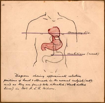 FeatureAppealTrib Herbert Wilson p4 680